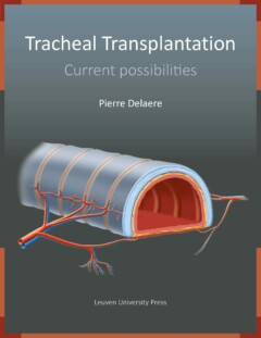 Book cover for Tracheal Transplantation